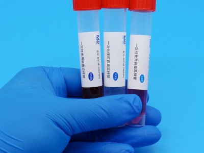 一次性使用病毒采样管(灭活型)(非灭活型)图1